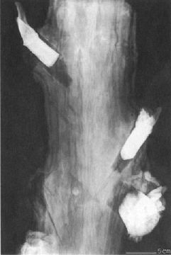 Die eingewachsenen Geweihstcke von Mnchen